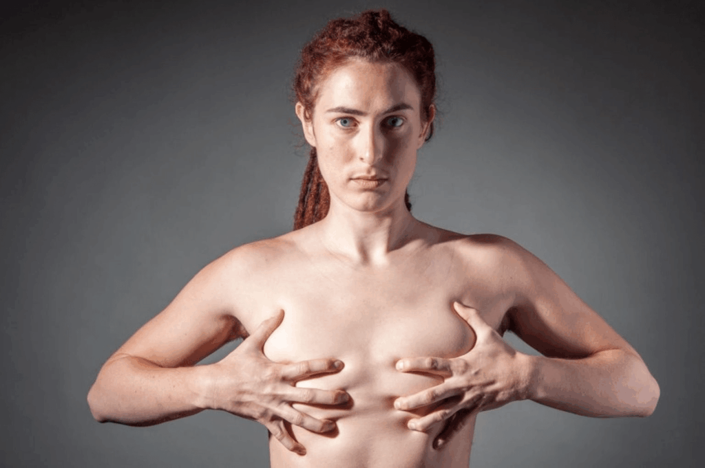 Kann ich mich einer Gesichtsverweiblichungsoperation unterziehen, während ich eine Hormonersatztherapie mache?