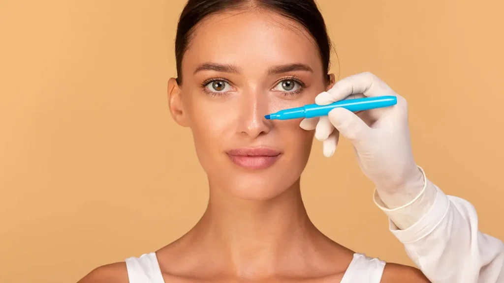 Nose reduction surgery