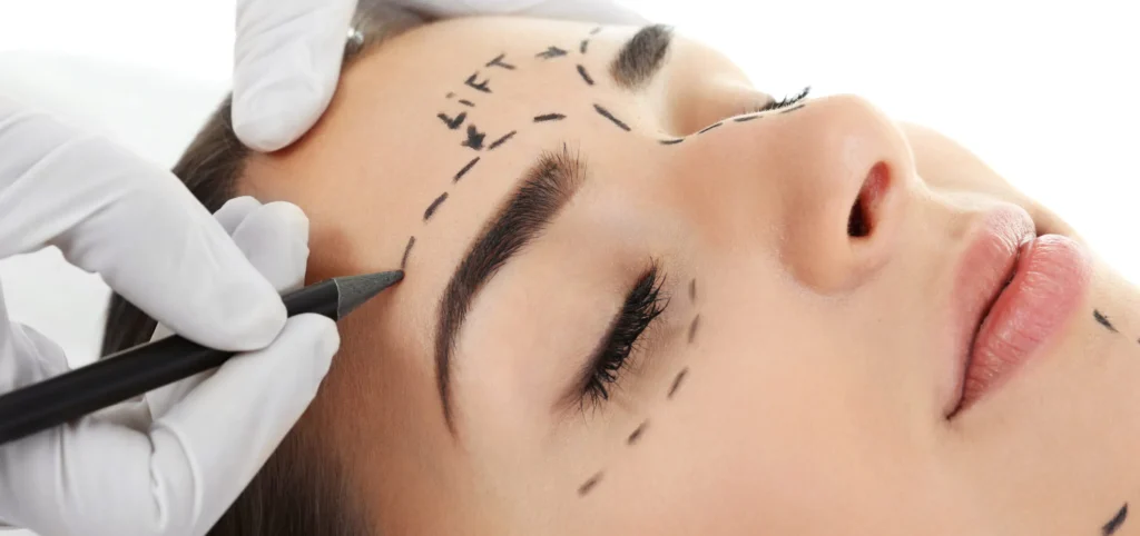 brow lift silkor 1 scaled e1676900159483