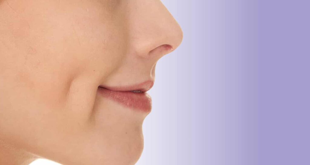 Chirurgie des fossettes : Cela vaut-il la peine de se faire opérer ? 1 fossette 1