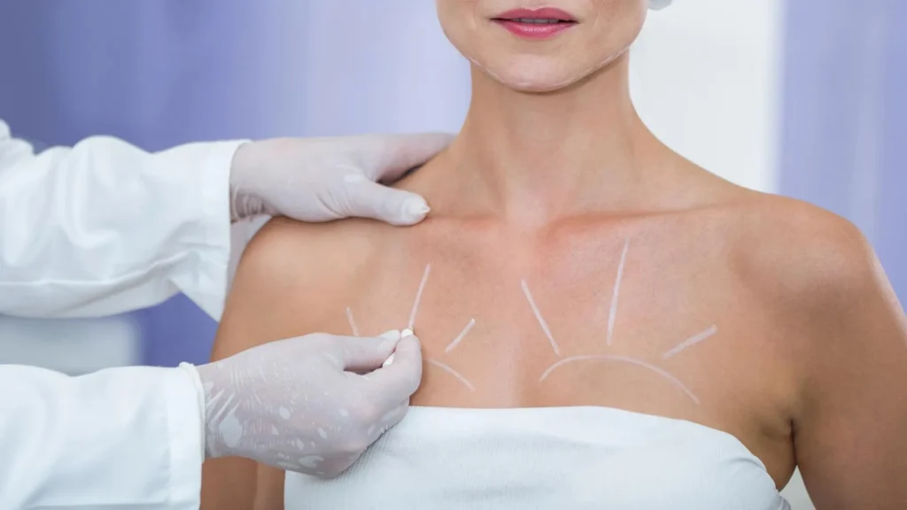 breast surgery