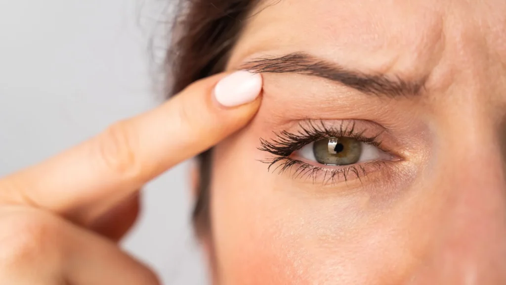 Lifting des yeux : tout ce que vous devez savoir 1 lifting des yeux