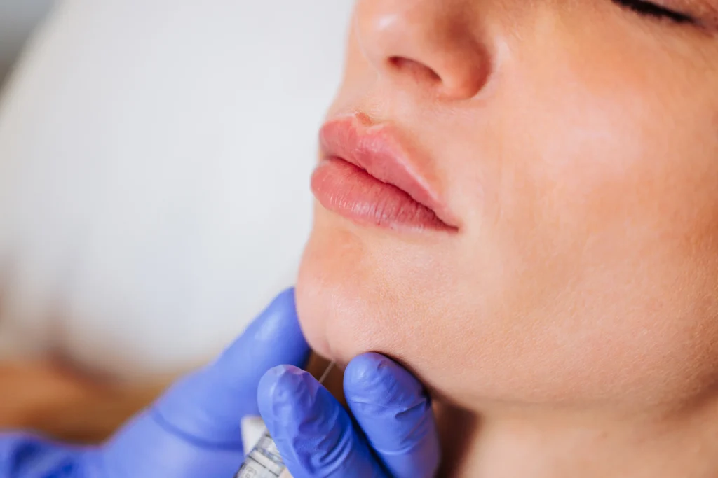 Rides et augmentation des lèvres : les subtilités d'un visage féminin en 3 étapes 2 153303747