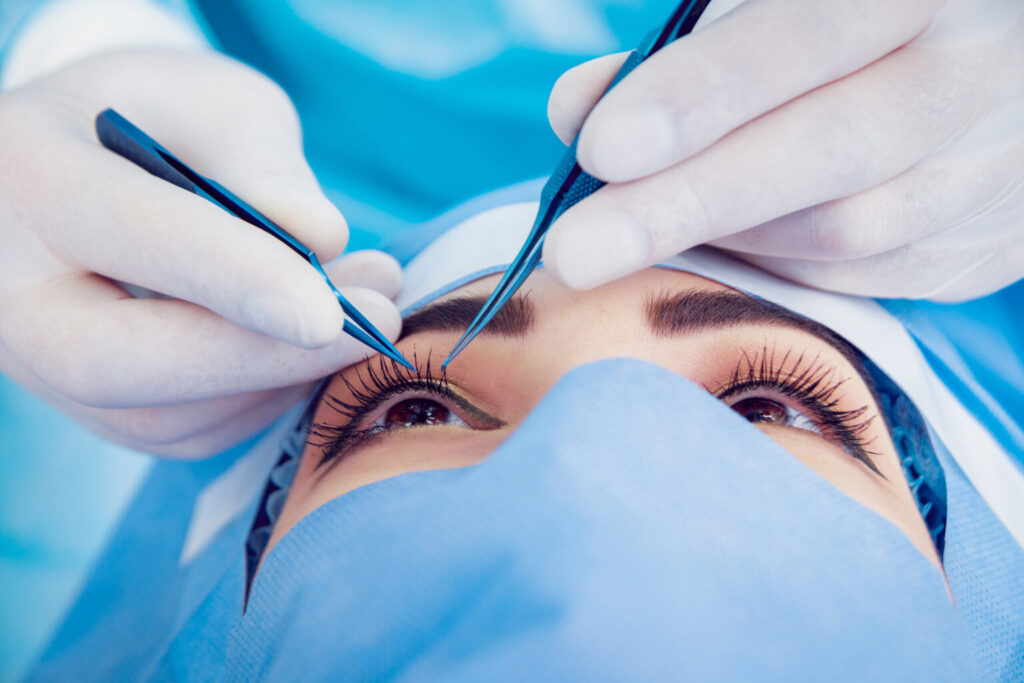 Eye Socket Reshaping Procedure: Lesser-Known Facts 6 370099826 1536x1025 1