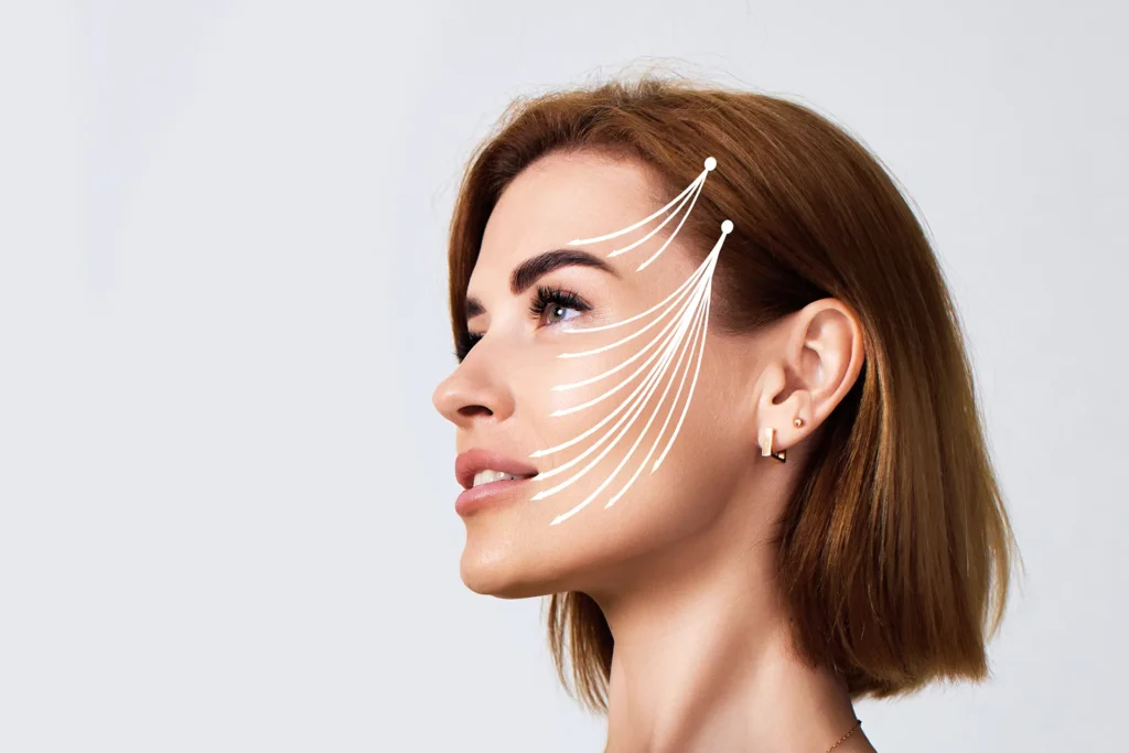 Facelift en draadlift: de geheimen van een blijvende jeugd 1 facelift