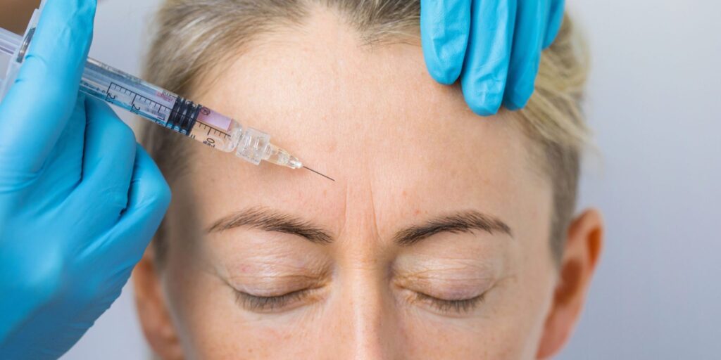 Chirurgie du front et des sourcils : un aperçu de l'expression féminine 1 front
