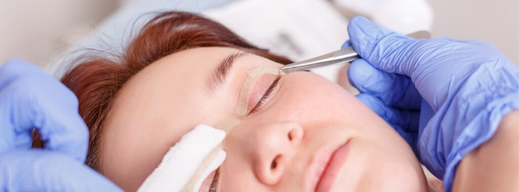 Are You a Suitable Candidate for Eyelid Surgery? 1 eyelid surgery