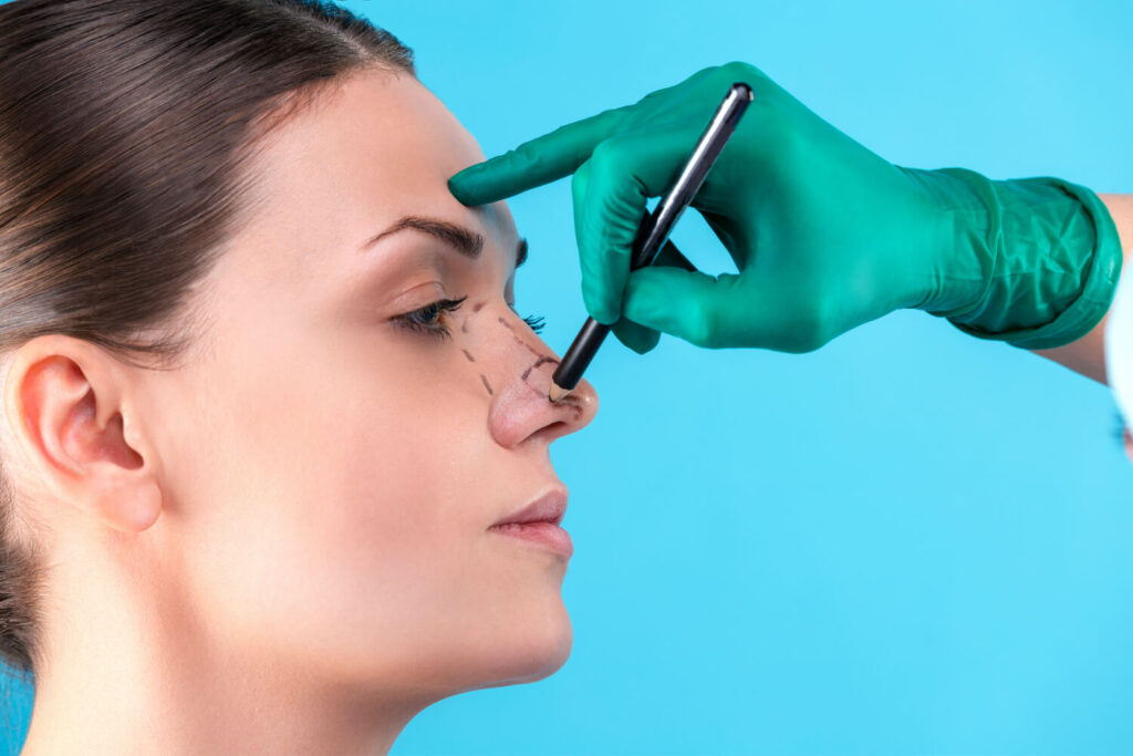 An Elegant Nose Tip: Adjusting the Lateral Crural Angle 1 nose tip