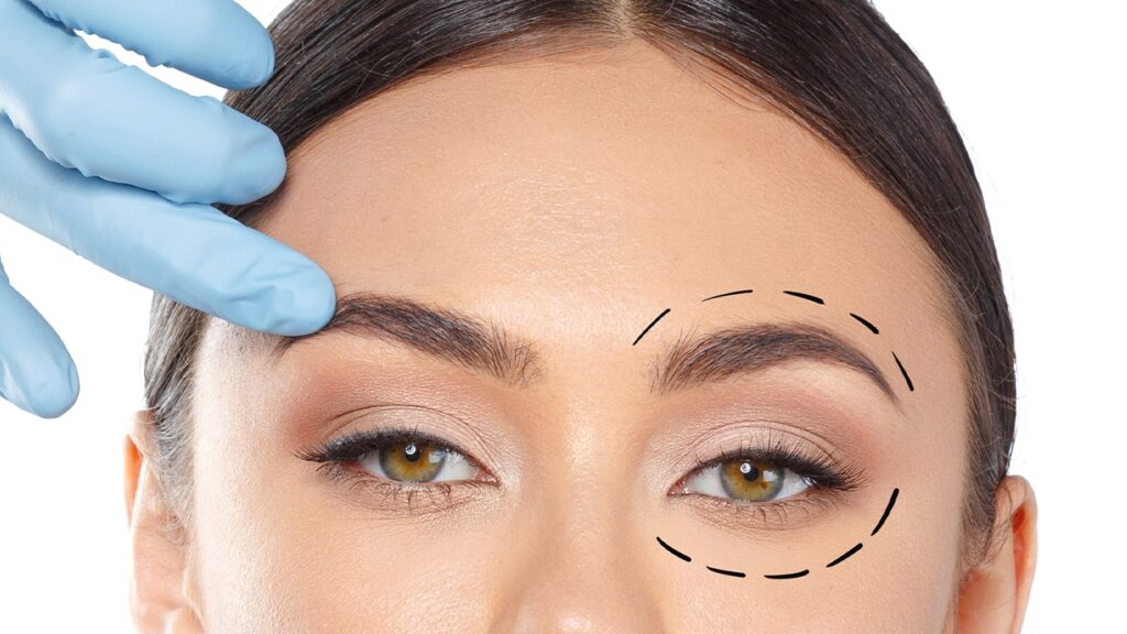 النساء المتحولات جنسياً