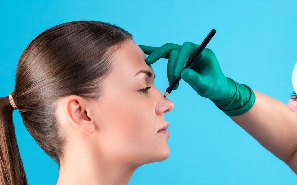 Quelle intervention chirurgicale devrait être la première dans le cadre d'une féminisation faciale ? 4 rhinoplastie
