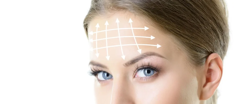 Forehead Contouring Surgery: A Feminine Touch to Facial Features 2 header browlift forehead